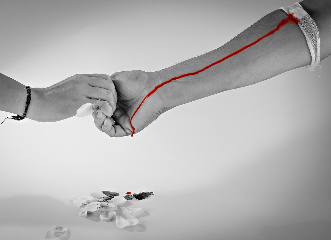 Risarcimento per trasfusione sangue infetto