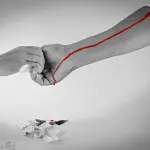 Risarcimento per trasfusione sangue infetto