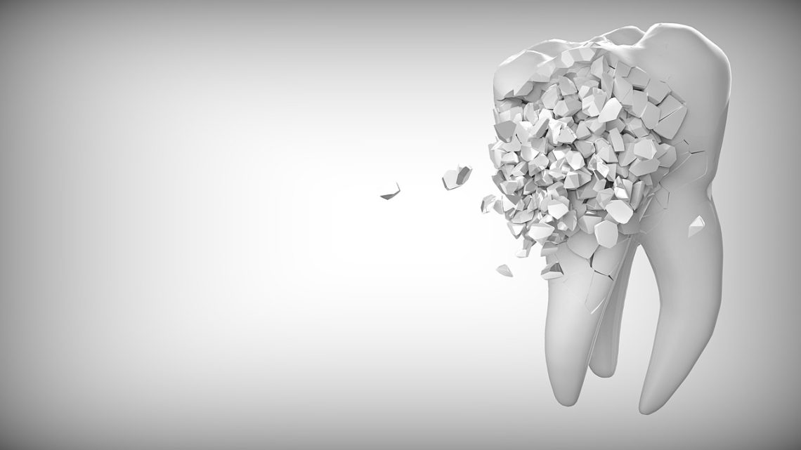 Come si forma la carie ai denti e come curarla